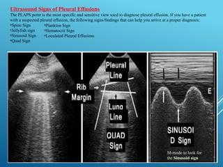 APPROACH TO POCUS IN ACUTE RESPIRATORY FAILURE.pptx
