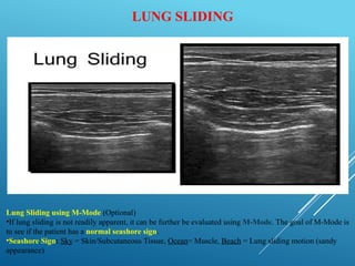 APPROACH TO POCUS IN ACUTE RESPIRATORY FAILURE.pptx