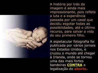 A história por trás da imagem é ainda mais impressionante, pois reflete a luta e a experiência passada por um casal que decidiu esgotar todas as possibilidades, até o último recurso, para salvar a vida do seu primeiro filho.A espetacular fotografia foi publicada por vários jornais nos Estados Unidos, e  cruzou o mundo até chegar  à Irlanda, onde se tornou uma das mais fortes bandeirasCONTRAa legalização doaborto.
