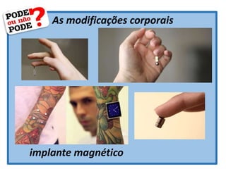 As modificações corporais
implante magnético
 
