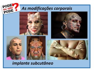 As modificações corporais
implante subcutâneo
 