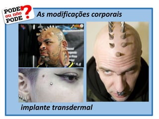 As modificações corporais
implante transdermal
 