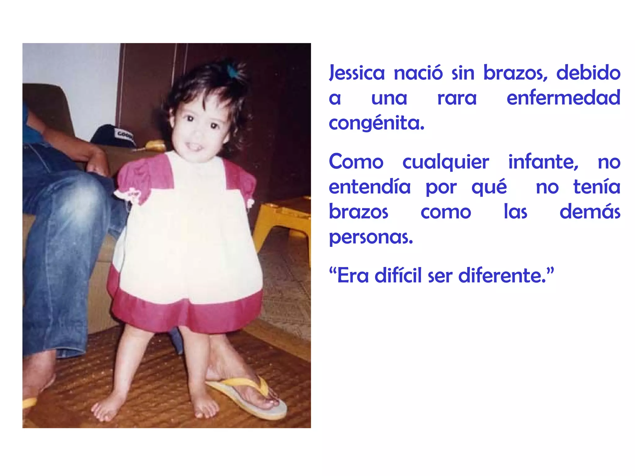 Jessica nació sin brazos, debido
a una rara enfermedad
congénita.
Como cualquier infante, no
entendía por qué no tenía
brazos como las demás
personas.
“Era difícil ser diferente.”
 