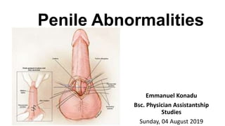Penile Abnormalities
Emmanuel Konadu
Bsc. Physician Assistantship
Studies
Sunday, 04 August 2019
 