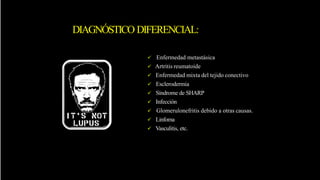 DIAGNÓSTICO DIFERENCIAL:
 Enfermedad metastásica
 Artritis reumatoide
 Enfermedad mixta del tejido conectivo
 Esclerodermia
 Síndrome de SHARP
 Infección
 Glomerulonefritis debido a otras causas.
 Linfoma
 Vasculitis, etc.
 