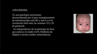 LUPUS NEONATAL:
Es una patología autoinmune
desencadenada por el paso transplacentario
de autoanticuerpos anti-Ro y anti-La en la
circulación fetal entre las semanas 18 y 24
de gestación.
Es independiente de la patología de base
que padezca la madre (LES, Síndrome de
Sjögren o incluso madres asintomáticas).
 