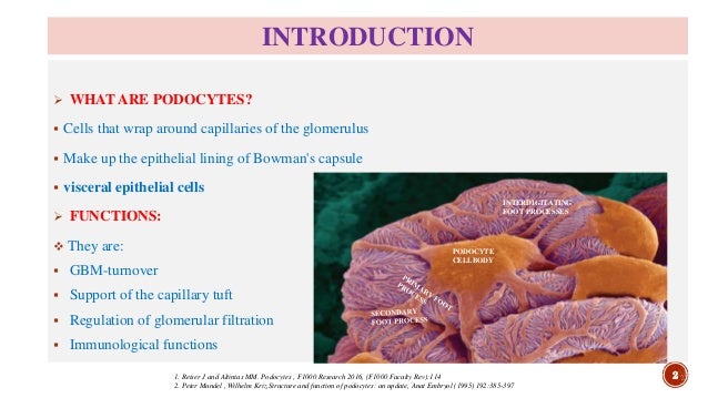 Podocyte Mediated Kidney Diseases Diabetic Nephropathy