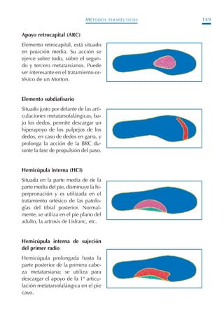 MÉTODOS TERAPÉUTICOS 149
Apoyo retrocapital (ARC)
Elemento retrocapital, está situado
en posición media. Su acción se
ejerce sobre todo, sobre el segun-
do y tercero metatarsianos. Puede
ser interesante en el tratamiento or-
tésico de un Morton.
Elemento subdiafisario
Situado justo por delante de las arti-
culaciones metatarsofalángicas, ba-
jo los dedos, permite descargar un
hiperapoyo de los pulpejos de los
dedos, en caso de dedos en garra, y
prolonga la acción de la BRC du-
rante la fase de propulsión del paso.
Hemicúpula interna (HCI)
Situada en la parte media de de la
parte media del pie, disminuye la hi-
perpronación y es utilizada en el
tratamiento ortésico de las patolo-
gías del tibial posterior. Normal-
mente, se utiliza en el pie plano del
adulto, la artrosis de Lisfranc, etc.
Hemicúpula interna de sujeción
del primer radio
Hemicúpula prolongada hasta la
parte posterior de la primera cabe-
za metatarsiana; se utiliza para
descargar el apoyo de la 1ª articu-
lación metatarsofalángica en el pie
cavo.
Podología geriátrica 001-382 3/8/07 10:21 Página 149
 