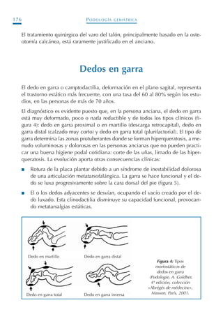 PODOLOGÍA GERIÁTRICA176
El tratamiento quirúrgico del varo del talón, principalmente basado en la oste-
otomía calcánea, está raramente justificado en el anciano.
Dedos en garra
El dedo en garra o camptodactilia, deformación en el plano sagital, representa
el trastorno estático más frecuente, con una tasa del 60 al 80% según los estu-
dios, en las personas de más de 70 años.
El diagnóstico es evidente puesto que, en la persona anciana, el dedo en garra
está muy deformado, poco o nada reductible y de todos los tipos clínicos (fi-
gura 4): dedo en garra proximal o en martillo (descarga retrocapital), dedo en
garra distal (calzado muy corto) y dedo en garra total (plurifactorial). El tipo de
garra determina las zonas protuberantes donde se forman hiperqueratosis, a me-
nudo voluminosas y dolorosas en las personas ancianas que no pueden practi-
car una buena higiene podal cotidiana: corte de las uñas, limado de las hiper-
queratosis. La evolución aporta otras consecuencias clínicas:
I Rotura de la placa plantar debido a un síndrome de inestabilidad dolorosa
de una articulación metatarsofalángica. La garra se hace funcional y el de-
do se luxa progresivamente sobre la cara dorsal del pie (figura 5).
I El o los dedos adyacentes se desvían, ocupando el vacío creado por el de-
do luxado. Esta clinodactilia disminuye su capacidad funcional, provocan-
do metatarsalgias estáticas.
Figura 4: Tipos
morfostáticos de
dedos en garra
(Podologie, A. Goldher,
4ª edición, colección
«Abrégés de médecine»,
Masson, París, 2001.
Dedo en martillo
Dedo en garra total Dedo en garra inversa
Dedo en garra distal
Podología geriátrica 001-382 3/8/07 10:21 Página 176
 