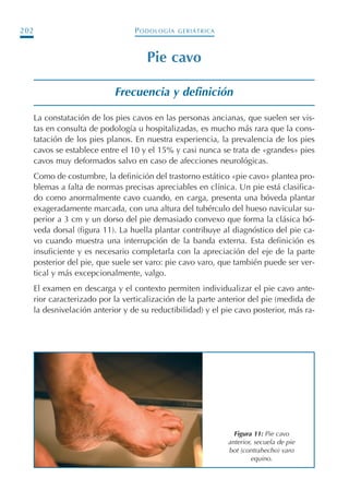 PODOLOGÍA GERIÁTRICA202
Pie cavo
Frecuencia y definición
La constatación de los pies cavos en las personas ancianas, que suelen ser vis-
tas en consulta de podología u hospitalizadas, es mucho más rara que la cons-
tatación de los pies planos. En nuestra experiencia, la prevalencia de los pies
cavos se establece entre el 10 y el 15% y casi nunca se trata de «grandes» pies
cavos muy deformados salvo en caso de afecciones neurológicas.
Como de costumbre, la definición del trastorno estático «pie cavo» plantea pro-
blemas a falta de normas precisas apreciables en clínica. Un pie está clasifica-
do como anormalmente cavo cuando, en carga, presenta una bóveda plantar
exageradamente marcada, con una altura del tubérculo del hueso navicular su-
perior a 3 cm y un dorso del pie demasiado convexo que forma la clásica bó-
veda dorsal (figura 11). La huella plantar contribuye al diagnóstico del pie ca-
vo cuando muestra una interrupción de la banda externa. Esta definición es
insuficiente y es necesario completarla con la apreciación del eje de la parte
posterior del pie, que suele ser varo: pie cavo varo, que también puede ser ver-
tical y más excepcionalmente, valgo.
El examen en descarga y el contexto permiten individualizar el pie cavo ante-
rior caracterizado por la verticalización de la parte anterior del pie (medida de
la desnivelación anterior y de su reductibilidad) y el pie cavo posterior, más ra-
Figura 11: Pie cavo
anterior, secuela de pie
bot (contrahecho) varo
equino.
Podología geriátrica 001-382 3/8/07 10:21 Página 202
 