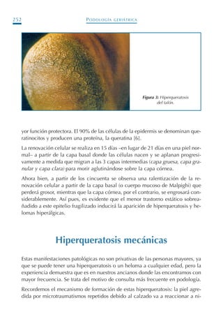 PODOLOGÍA GERIÁTRICA252
yor función protectora. El 90% de las células de la epidermis se denominan que-
ratinocitos y producen una proteína, la queratina [6].
La renovación celular se realiza en 15 días –en lugar de 21 días en una piel nor-
mal– a partir de la capa basal donde las células nacen y se aplanan progresi-
vamente a medida que migran a las 3 capas intermedias (capa gruesa, capa gra-
nular y capa clara) para morir aglutinándose sobre la capa córnea.
Ahora bien, a partir de los cincuenta se observa una ralentización de la re-
novación celular a partir de la capa basal (o cuerpo mucoso de Malpighi) que
perderá grosor, mientras que la capa córnea, por el contrario, se engrosará con-
siderablemente. Así pues, es evidente que el menor trastorno estático sobrea-
ñadido a este epitelio fragilizado inducirá la aparición de hiperqueratosis y he-
lomas hiperálgicas.
Hiperqueratosis mecánicas
Estas manifestaciones patológicas no son privativas de las personas mayores, ya
que se puede tener una hiperqueratosis o un heloma a cualquier edad, pero la
experiencia demuestra que es en nuestros ancianos donde las encontramos con
mayor frecuencia. Se trata del motivo de consulta más frecuente en podología.
Recordemos el mecanismo de formación de estas hiperqueratosis: la piel agre-
dida por microtraumatismos repetidos debido al calzado va a reaccionar a ni-
Figura 3: Hiperqueratosis
del talón.
Podología geriátrica 001-382 3/8/07 10:21 Página 252
 