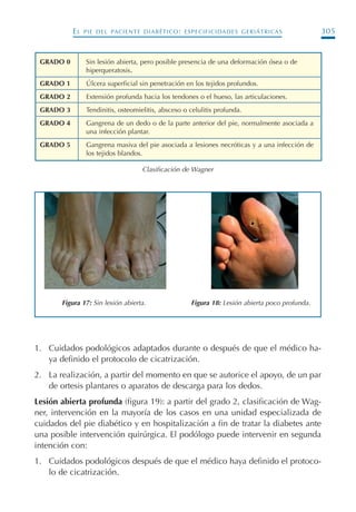 EL PIE DEL PACIENTE DIABÉTICO: ESPECIFICIDADES GERIÁTRICAS 305
1. Cuidados podológicos adaptados durante o después de que el médico ha-
ya definido el protocolo de cicatrización.
2. La realización, a partir del momento en que se autorice el apoyo, de un par
de ortesis plantares o aparatos de descarga para los dedos.
Lesión abierta profunda (figura 19): a partir del grado 2, clasificación de Wag-
ner, intervención en la mayoría de los casos en una unidad especializada de
cuidados del pie diabético y en hospitalización a fin de tratar la diabetes ante
una posible intervención quirúrgica. El podólogo puede intervenir en segunda
intención con:
1. Cuidados podológicos después de que el médico haya definido el protoco-
lo de cicatrización.
GRADO 0 Sin lesión abierta, pero posible presencia de una deformación ósea o de
hiperqueratosis.
GRADO 1 Úlcera superficial sin penetración en los tejidos profundos.
GRADO 2 Extensión profunda hacia los tendones o el hueso, las articulaciones.
GRADO 3 Tendinitis, osteomielitis, absceso o celulitis profunda.
GRADO 4 Gangrena de un dedo o de la parte anterior del pie, normalmente asociada a
una infección plantar.
GRADO 5 Gangrena masiva del pie asociada a lesiones necróticas y a una infección de
los tejidos blandos.
Clasificación de Wagner
Figura 17: Sin lesión abierta. Figura 18: Lesión abierta poco profunda.
Podología geriátrica 001-382 3/8/07 10:22 Página 305
 