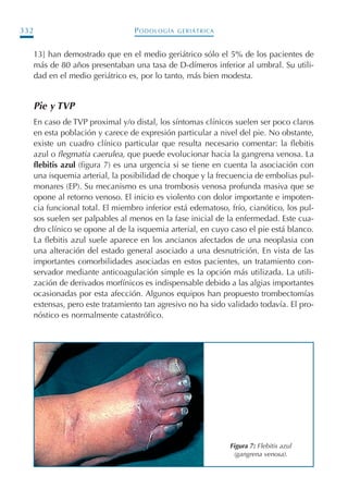 PODOLOGÍA GERIÁTRICA332
13] han demostrado que en el medio geriátrico sólo el 5% de los pacientes de
más de 80 años presentaban una tasa de D-dímeros inferior al umbral. Su utili-
dad en el medio geriátrico es, por lo tanto, más bien modesta.
Pie y TVP
En caso de TVP proximal y/o distal, los síntomas clínicos suelen ser poco claros
en esta población y carece de expresión particular a nivel del pie. No obstante,
existe un cuadro clínico particular que resulta necesario comentar: la flebitis
azul o flegmatia caerulea, que puede evolucionar hacia la gangrena venosa. La
flebitis azul (figura 7) es una urgencia si se tiene en cuenta la asociación con
una isquemia arterial, la posibilidad de choque y la frecuencia de embolias pul-
monares (EP). Su mecanismo es una trombosis venosa profunda masiva que se
opone al retorno venoso. El inicio es violento con dolor importante e impoten-
cia funcional total. El miembro inferior está edematoso, frío, cianótico, los pul-
sos suelen ser palpables al menos en la fase inicial de la enfermedad. Este cua-
dro clínico se opone al de la isquemia arterial, en cuyo caso el pie está blanco.
La flebitis azul suele aparece en los ancianos afectados de una neoplasia con
una alteración del estado general asociado a una desnutrición. En vista de las
importantes comorbilidades asociadas en estos pacientes, un tratamiento con-
servador mediante anticoagulación simple es la opción más utilizada. La utili-
zación de derivados morfínicos es indispensable debido a las algias importantes
ocasionadas por esta afección. Algunos equipos han propuesto trombectomías
extensas, pero este tratamiento tan agresivo no ha sido validado todavía. El pro-
nóstico es normalmente catastrófico.
Figura 7: Flebitis azul
(gangrena venosa).
Podología geriátrica 001-382 3/8/07 10:22 Página 332
 