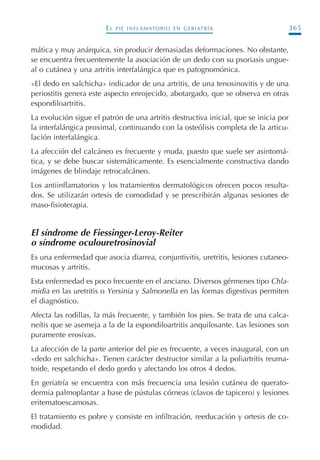 EL PIE INFLAMATORIO EN GERIATRÍA 365
mática y muy anárquica, sin producir demasiadas deformaciones. No obstante,
se encuentra frecuentemente la asociación de un dedo con su psoriasis ungue-
al o cutánea y una artritis interfalángica que es patognomónica.
«El dedo en salchicha» indicador de una artritis, de una tenosinovitis y de una
periostitis genera este aspecto enrojecido, abotargado, que se observa en otras
espondiloartritis.
La evolución sigue el patrón de una artritis destructiva inicial, que se inicia por
la interfalángica proximal, continuando con la osteólisis completa de la articu-
lación interfalángica.
La afección del calcáneo es frecuente y muda, puesto que suele ser asintomá-
tica, y se debe buscar sistemáticamente. Es esencialmente constructiva dando
imágenes de blindaje retrocalcáneo.
Los antiinflamatorios y los tratamientos dermatológicos ofrecen pocos resulta-
dos. Se utilizarán ortesis de comodidad y se prescribirán algunas sesiones de
maso-fisioterapia.
El síndrome de Fiessinger-Leroy-Reiter
o síndrome oculouretrosinovial
Es una enfermedad que asocia diarrea, conjuntivitis, uretritis, lesiones cutaneo-
mucosas y artritis.
Esta enfermedad es poco frecuente en el anciano. Diversos gérmenes tipo Chla-
midia en las uretritis o Yersinia y Salmonella en las formas digestivas permiten
el diagnóstico.
Afecta las rodillas, la más frecuente, y también los pies. Se trata de una calca-
neítis que se asemeja a la de la espondiloartritis anquilosante. Las lesiones son
puramente erosivas.
La afección de la parte anterior del pie es frecuente, a veces inaugural, con un
«dedo en salchicha». Tienen carácter destructor similar a la poliartritis reuma-
toide, respetando el dedo gordo y afectando los otros 4 dedos.
En geriatría se encuentra con más frecuencia una lesión cutánea de querato-
dermia palmoplantar a base de pústulas córneas (clavos de tapicero) y lesiones
eritematoescamosas.
El tratamiento es pobre y consiste en infiltración, reeducación y ortesis de co-
modidad.
Podología geriátrica 001-382 3/8/07 10:23 Página 365
 