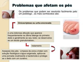 Problemas que afetam os pés
Os problemas que podem ser resolvido facilmente pelo
um podologo , os mais conhecidos são:
Onicocriptose ou unha encravada
é uma dolorosa afecção que aparece
frequentemente na última falange do primeiro
dedo e geralmente ao seu redor, se desenvolve-
se um tecido granulomatoso..
tratamento
Assepsia dos pés; Limpeza da zona a tratar com
solução fisiológica e água oxigenada, aplica-se
uma pomada cicatrizante e bactericida e protege-
se o dedo com um curativo.
 