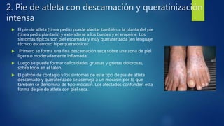 2. Pie de atleta con descamación y queratinización
intensa
 El pie de atleta (tinea pedis) puede afectar también a la planta del pie
(tinea pedis plantaris) y extenderse a los bordes y el empeine. Los
síntomas típicos son piel escamada y muy queraterizada (en lenguaje
técnico escamoso hiperqueratósico):
 Primero se forma una fina descamación seca sobre una zona de piel
ligera o moderadamente inflamada.
 Luego se puede formar callosidades gruesas y grietas dolorosas,
sobre todo en el talón.
 El patrón de contagio y los síntomas de este tipo de pie de atleta
descamado y queraterizado se asemeja a un mocasín por lo que
también se denomina de tipo mocasín. Los afectados confunden esta
forma de pie de atleta con piel seca.
 