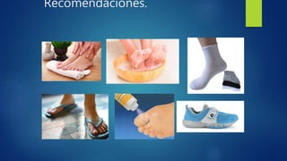 Recomendaciones.
 