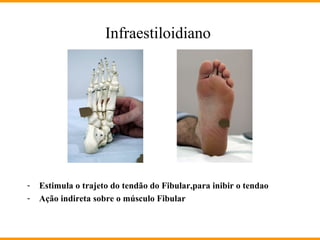 Infraestiloidiano
- Estimula o trajeto do tendão do Fibular,para inibir o tendao
- Ação indireta sobre o músculo Fibular
 
