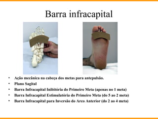 • Ação mecânica na cabeça dos metas para antepulsão.
• Plano Sagital
• Barra Infracapital Inibitória do Primeiro Meta (apenas no 1 meta)
• Barra Infracapital Estimulatória do Primeiro Meta (do 5 ao 2 meta)
• Barra Infracapital para Inversão do Arco Anterior (do 2 ao 4 meta)
Barra infracapital
 
