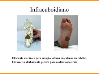 Infracuboidiano
- Elemento mecânico para rotação interna ou externa do cubóide
- Favorece o alinhamento pélvico para os desvios laterais
 