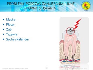 Podstawowy kurs nurkowy OWD – prezentacja IANTD