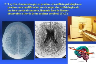 2 ª Ley En el momento que se produce el conflicto psicológico se produce una modificación en el campo electrofisiologico de un área cerebral concreta, llamado foco de Hamer, observable a través de un escáner cerebral (TAC) . 