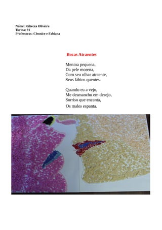 Nome: Rebecca Oliveira 
Turma: 91 
Professoras: Cleonice e Fabiana 
Bocas Atraentes 
Menina pequena, 
Da pele morena, 
Com seu olhar atraente, 
Seus lábios quentes. 
Quando eu a vejo, 
Me desmancho em desejo, 
Sorriso que encanta, 
Os males espanta. 
