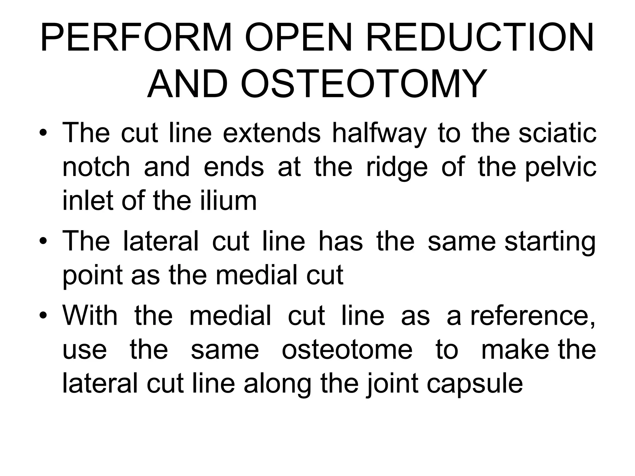 PERFORM OPEN REDUCTION
AND OSTEOTOMY
• The cut line extends halfway to the sciatic
notch and ends at the ridge of the pelvic
inlet of the ilium
• The lateral cut line has the same starting
point as the medial cut
• With the medial cut line as a reference,
use the same osteotome to make the
lateral cut line along the joint capsule
 