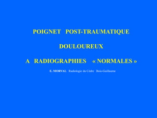 POIGNET POST-TRAUMATIQUE
DOULOUREUX
A RADIOGRAPHIES « NORMALES »
E. MORVAL Radiologie du Cèdre Bois-Guillaume
 