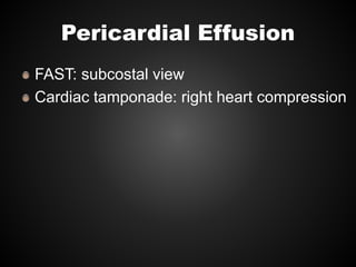 Pericardial Effusion
FAST: subcostal view
Cardiac tamponade: right heart compression
 