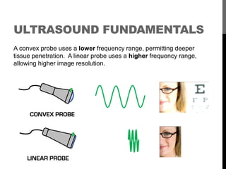 ULTRASOUND FUNDAMENTALS
A convex probe uses a lower frequency range, permitting deeper
tissue penetration. A linear probe ...