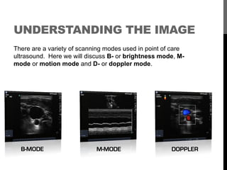 UNDERSTANDING THE IMAGE
There are a variety of scanning modes used in point of care
ultrasound. Here we will discuss B- or...