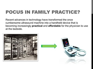 POCUS IN FAMILY PRACTICE?
It is important to remember that pocus is a user-dependent tool
requiring practice and expertise...