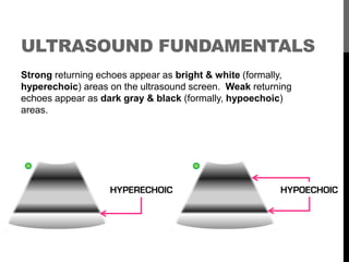 ULTRASOUND FUNDAMENTALS
Strong returning echoes appear as bright & white (formally,
hyperechoic) areas on the ultrasound s...