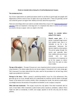 Points to Consider before Going for a Total Hip Replacement Surgery
The introductory facts
Hip or knee replacements are painful procedures which no one likes to go through, but people with
degenerative arthritis seem to have no option but to go ahead with it. These are generally carried
out so that the person can regain their mobility and move about like anyone else.
There are some things which one needs to consider before they can go in for a total hip replacement
operation which are important in the long term. It is important that when it comes to such issues,
you need to choose a surgeon who is an expert in the field.

Aspects to consider before
going for the surgery
Chronic severe pain - If a
person is going through severe
and constant pain, then it is
advisable to go for a hip
replacement, otherwise the
doctors might try other options.
The person going through the
severe pain generally loses
their mobility and cannot move
around,
and
in
such
circumstances it is important to
go for the surgery to relieve
them from the pain to make
them mobile.
The age of the patient – The age of the person is very important when it comes to carrying out such
a big procedure. The doctors generally do not choose surgery if the patient is of a very young age.
This is because it has been noticed that the joints used for the procedure do not last long, which
might cause problems in the future.
Damage to the bone – When a person is pondering whether to go for a hip replacement, they
generally go for an X-ray, through which one understands the situation and the extent of damage
caused to the bones due to severe arthritis. After reviewing the results, the doctors would advise
accordingly based on the severity of the problem and whether or not a surgery is required.
Other alternate treatments – The surgery may be the only option if the other treatments did not
work or have failed. Other treatments usually include various injections, antibiotics, walkers. These
might not work on everybody, in which case surgery appears to be the only way out for those
patients.

 