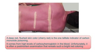 A deep red, flushed skin color (cherry red) is the one telltale indicator of carbon
monoxide poisoning.
It comes from high levels of carboxyhemoglobin in the blood. Unfortunately, it
is often a postmortem examination that reveals such a bright red coloring
 