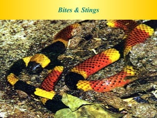 Bites & Stings 