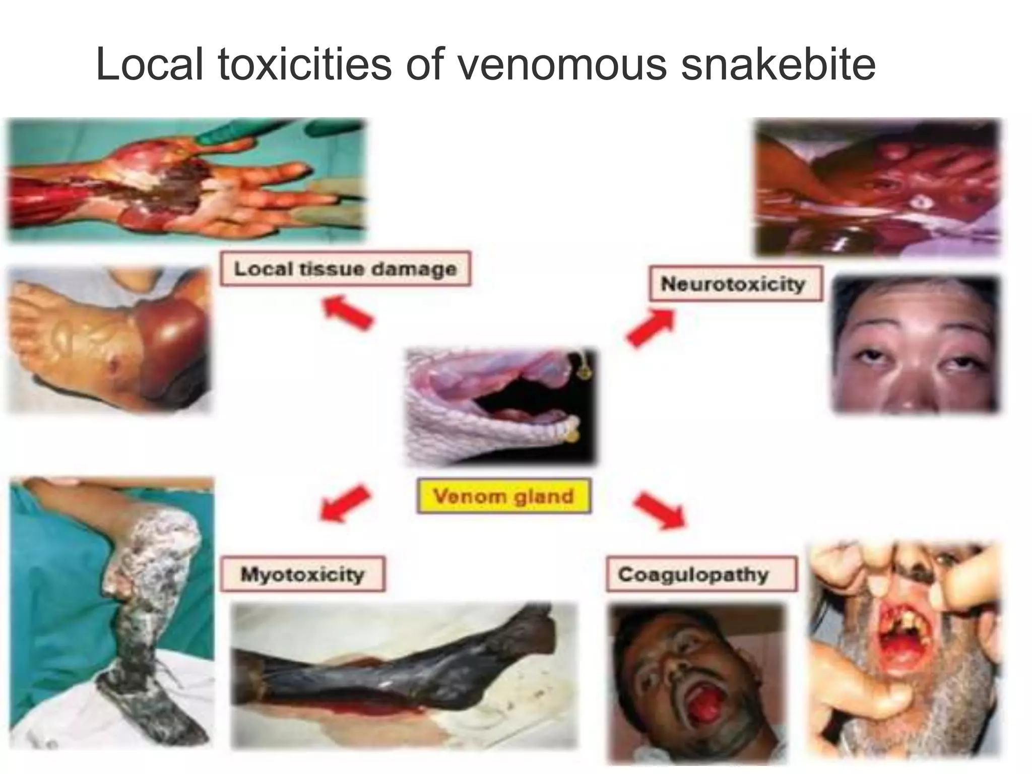 Local toxicities of venomous snakebite
 