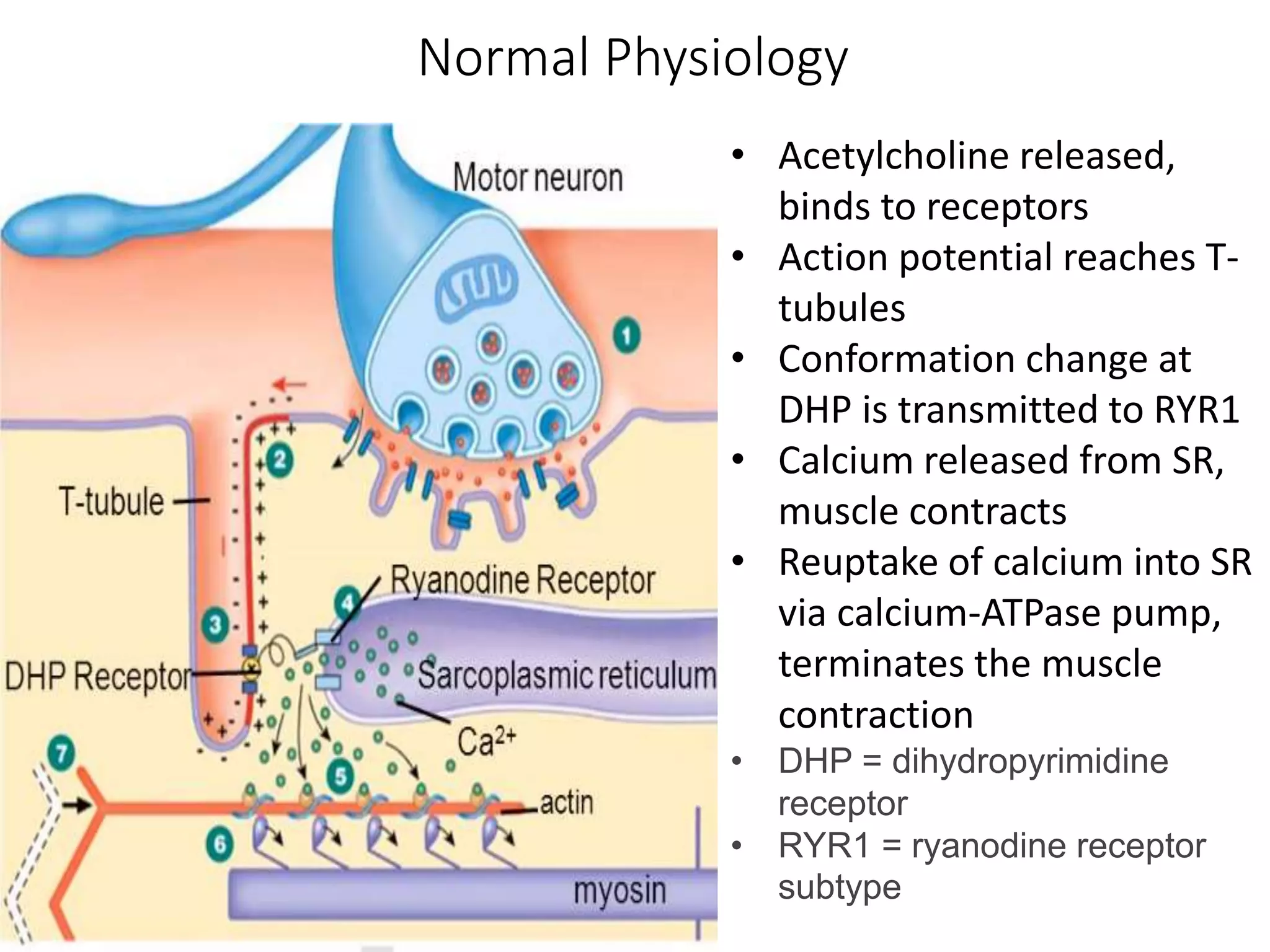 Normal Physiology
• Acetylcholine released,
binds to receptors
• Action potential reaches T-
tubules
• Conformation change at
DHP is transmitted to RYR1
• Calcium released from SR,
muscle contracts
• Reuptake of calcium into SR
via calcium-ATPase pump,
terminates the muscle
contraction
• DHP = dihydropyrimidine
receptor
• RYR1 = ryanodine receptor
subtype
 