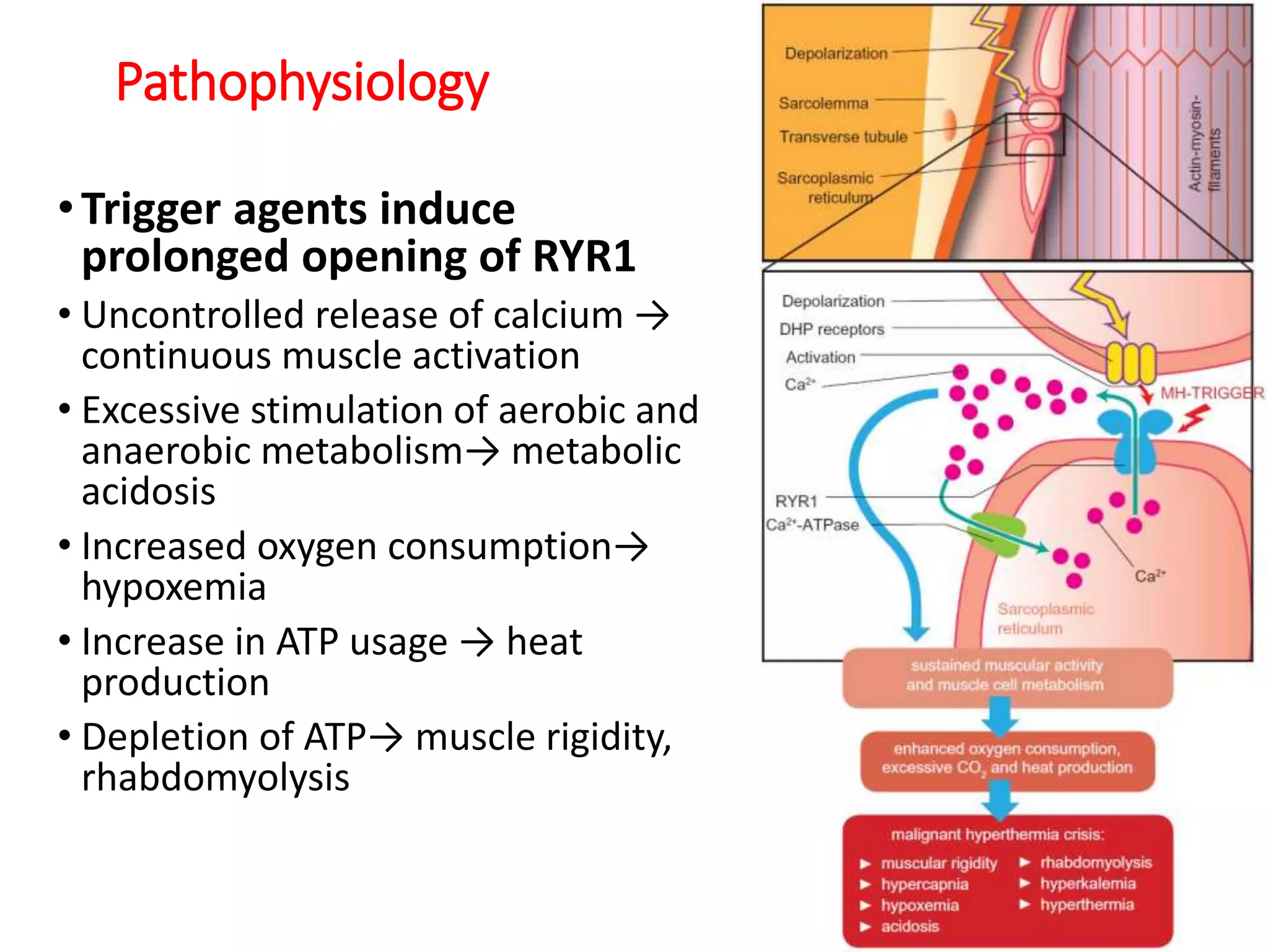 Pathophysiology
•Trigger agents induce
prolonged opening of RYR1
• Uncontrolled release of calcium →
continuous muscle activation
• Excessive stimulation of aerobic and
anaerobic metabolism→ metabolic
acidosis
• Increased oxygen consumption→
hypoxemia
• Increase in ATP usage → heat
production
• Depletion of ATP→ muscle rigidity,
rhabdomyolysis
 