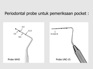 Periodontal probe untuk pemeriksaan pocket :
3.5
5.5
8.5
11.5
1mm→
Probe WHO Probe UNC-15
 