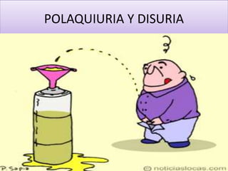 POLAQUIURIA Y DISURIA
 