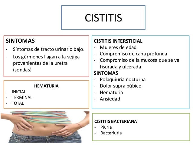 Polaquiuria y disuria Polaquiuria y disuria