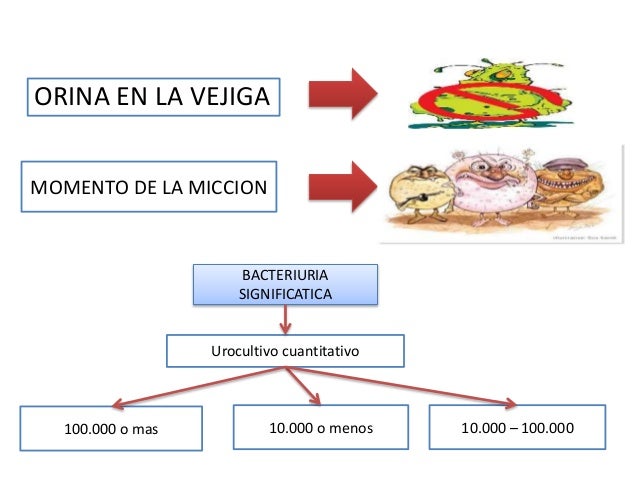 Polaquiuria y disuria
