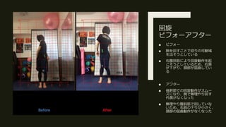 回旋
ビフォーアフター
■ ビフォー
■ 腕を回すことで捻りの可動域
を出そうとしている
■ 右腹斜筋により回旋動作を起
こそうとしているため、右肩
が下がり、頚部が屈曲してい
る
■ アフター
■ 体幹部での回旋動作がスムー
ズになり、腕で無理やり回す
代償がなくなった
■ 無理やり腹斜筋で回していな
いため、右肩の下りが小さく、
頚部の屈曲動作がなくなった
 