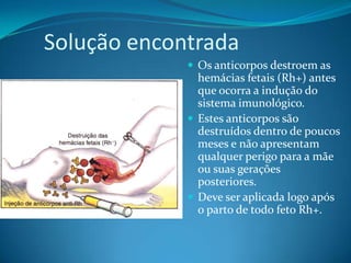 Solução encontrada
 Os anticorpos destroem as
hemácias fetais (Rh+) antes
que ocorra a indução do
sistema imunológico.
 Estes anticorpos são
destruídos dentro de poucos
meses e não apresentam
qualquer perigo para a mãe
ou suas gerações
posteriores.
 Deve ser aplicada logo após
o parto de todo feto Rh+.
 