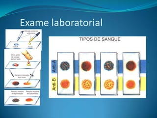 Exame laboratorial
 