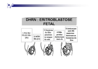 POLIALELÍSMO - GRUPOS SANGUÍNEOS