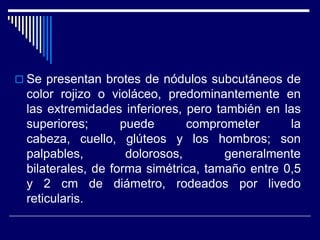  Se presentan brotes de nódulos subcutáneos de
 color rojizo o violáceo, predominantemente en
 las extremidades inferiores, pero también en las
 superiores;       puede       comprometer      la
 cabeza, cuello, glúteos y los hombros; son
 palpables,         dolorosos,       generalmente
 bilaterales, de forma simétrica, tamaño entre 0,5
 y 2 cm de diámetro, rodeados por livedo
 reticularis.
 