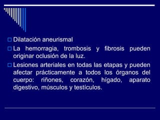  Dilatación aneurismal
 La hemorragia,     trombosis y fibrosis pueden
  originar oclusión de la luz.
 Lesiones arteriales en todas las etapas y pueden
  afectar prácticamente a todos los órganos del
  cuerpo: riñones, corazón, hígado, aparato
  digestivo, músculos y testículos.
 